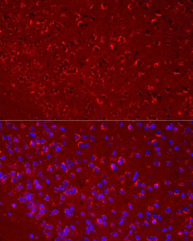 DKK3 Antibody in Immunocytochemistry (ICC/IF)