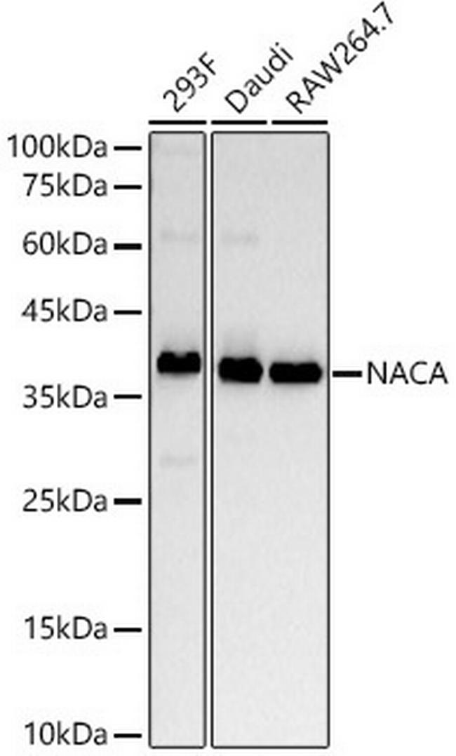 NACA Antibody in Western Blot (WB)