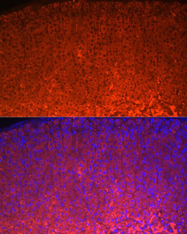 STAR Antibody in Immunocytochemistry (ICC/IF)