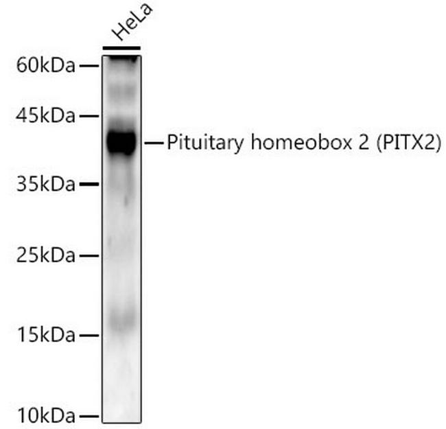 PITX2 Antibody in Western Blot (WB)