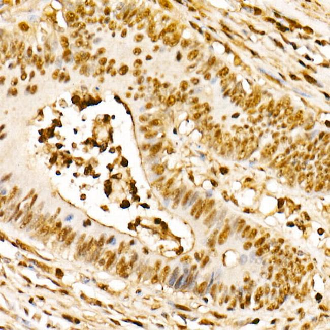 NAMPT Antibody in Immunohistochemistry (Paraffin) (IHC (P))