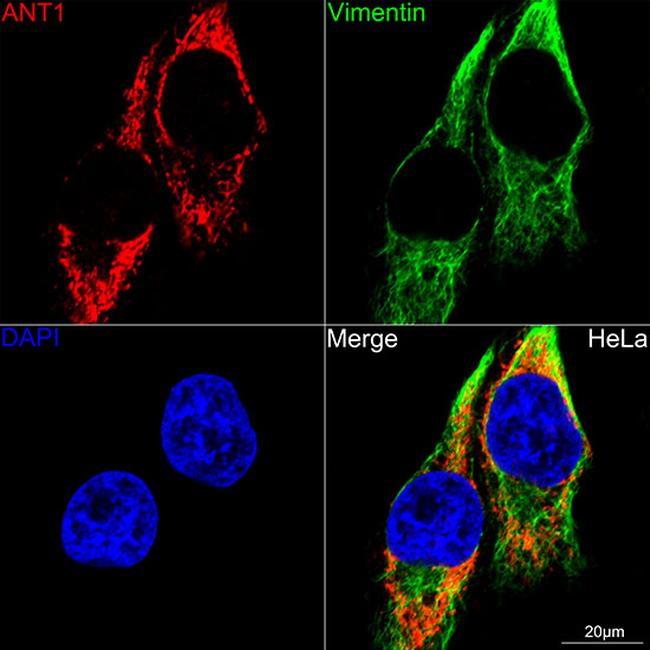 ANT Antibody in Immunocytochemistry (ICC/IF)