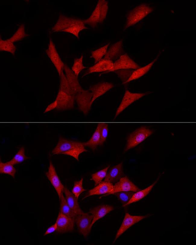 AKR1B1 Antibody in Immunocytochemistry (ICC/IF)