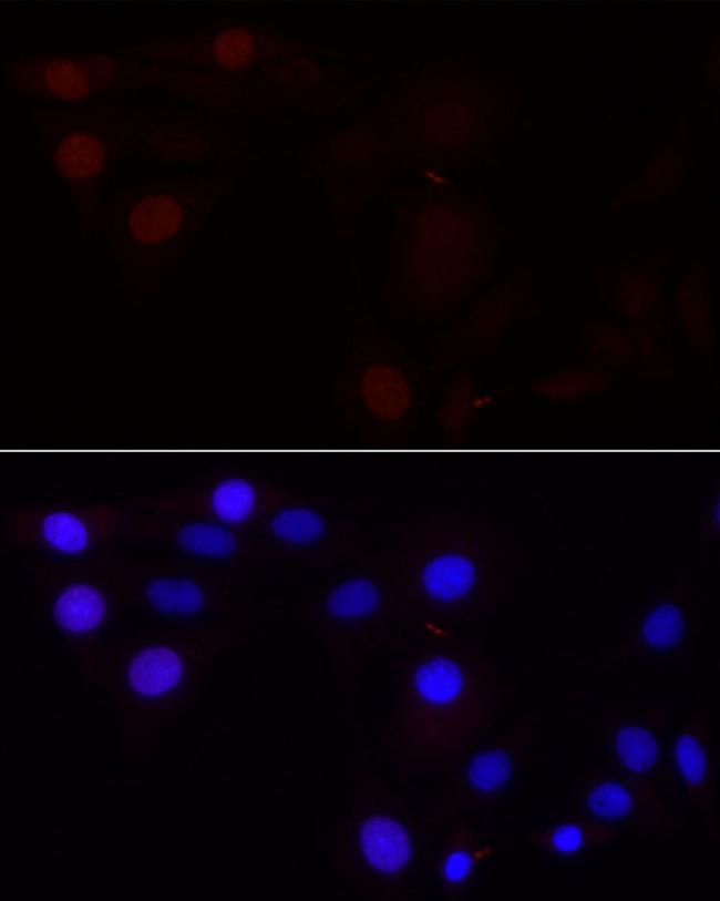 Aurora B Antibody in Immunocytochemistry (ICC/IF)