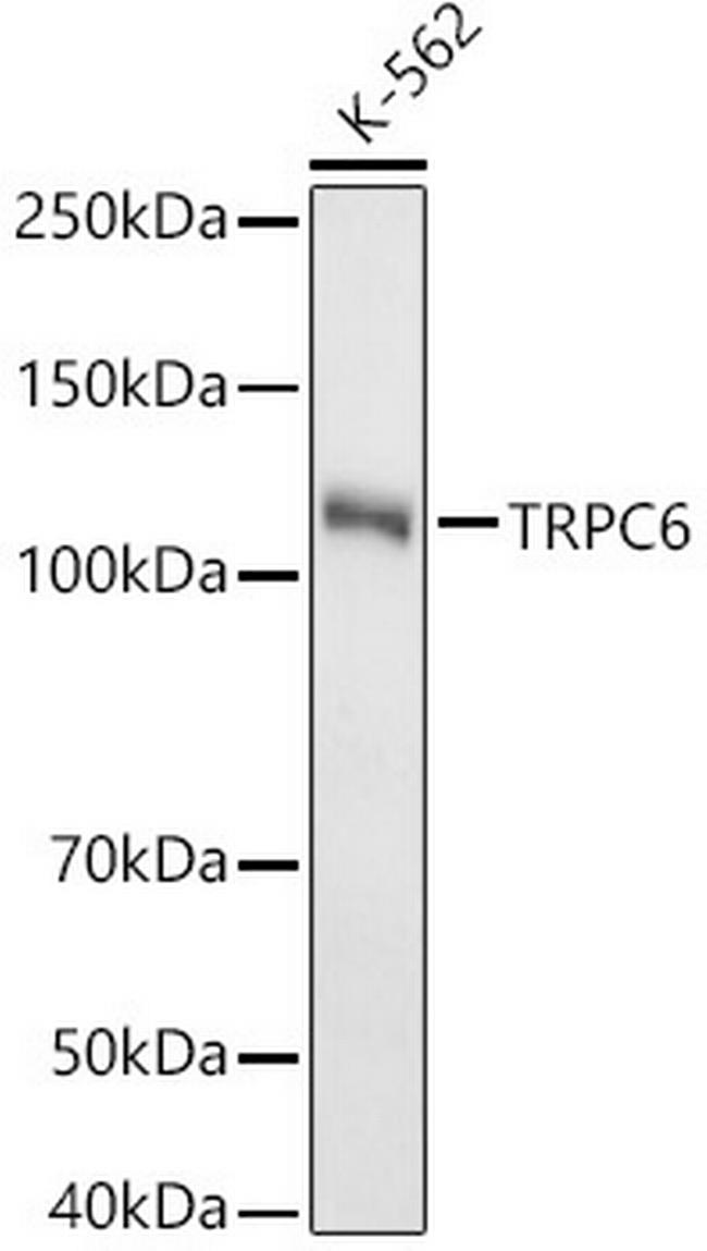 TRPC6 Antibody in Western Blot (WB)