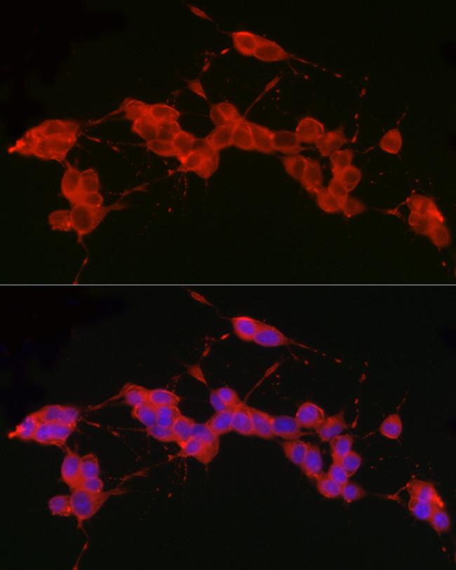 RET Antibody in Immunocytochemistry (ICC/IF)