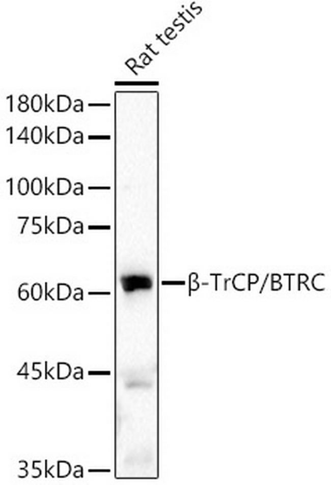 BTRC Antibody in Western Blot (WB)