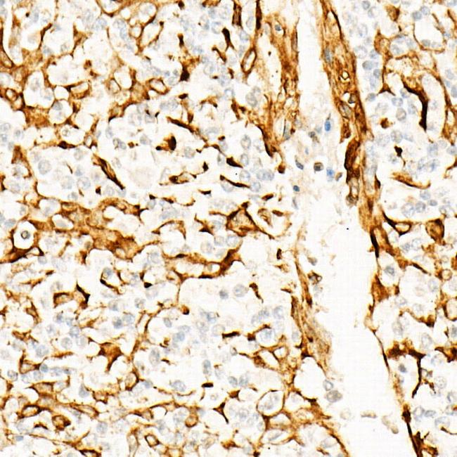 STING Antibody in Immunohistochemistry (Paraffin) (IHC (P))