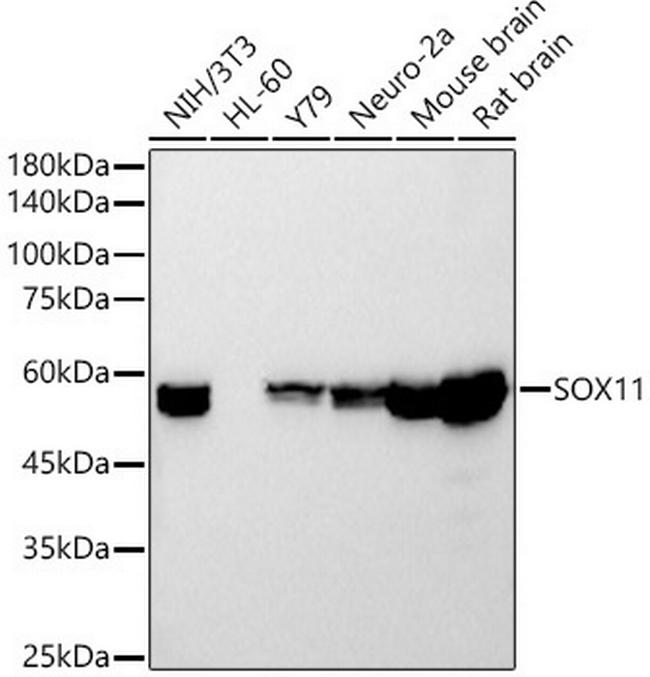 SOX11 Antibody in Western Blot (WB)