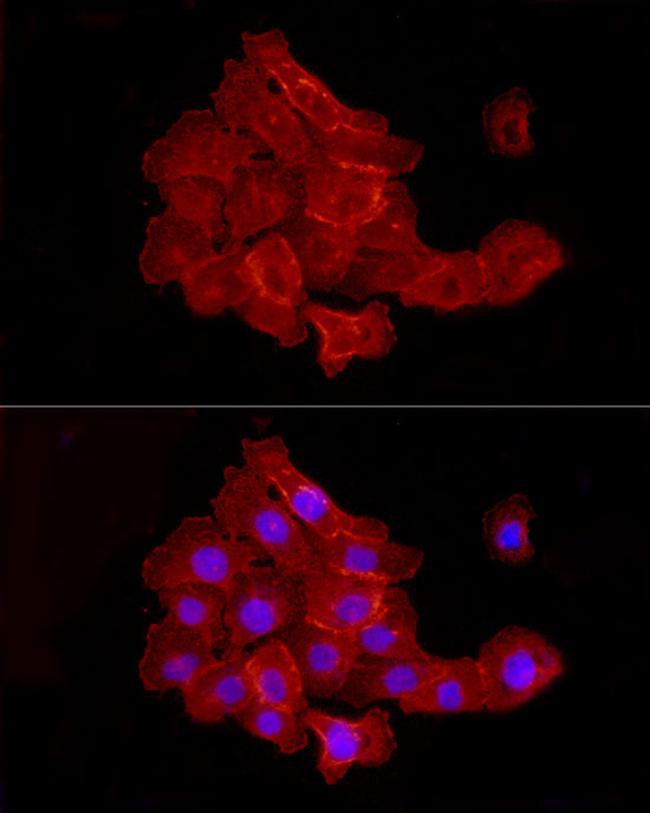 JAM-A (CD321) Antibody in Immunocytochemistry (ICC/IF)