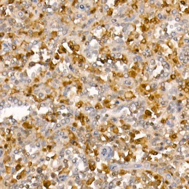 PYCARD Antibody in Immunohistochemistry (Paraffin) (IHC (P))