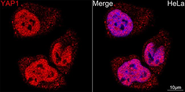 YAP1 Antibody in Immunocytochemistry (ICC/IF)