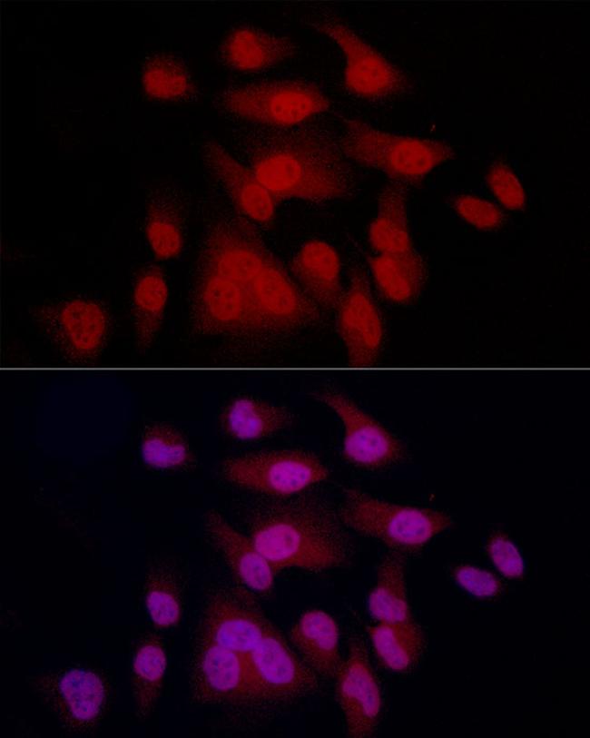 MiTF Antibody in Immunocytochemistry (ICC/IF)