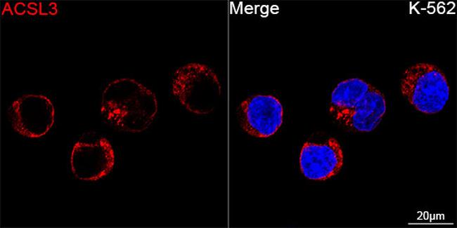 ACSL3 Antibody in Immunocytochemistry (ICC/IF)