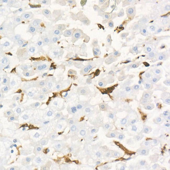 Gelsolin Antibody in Immunohistochemistry (Paraffin) (IHC (P))