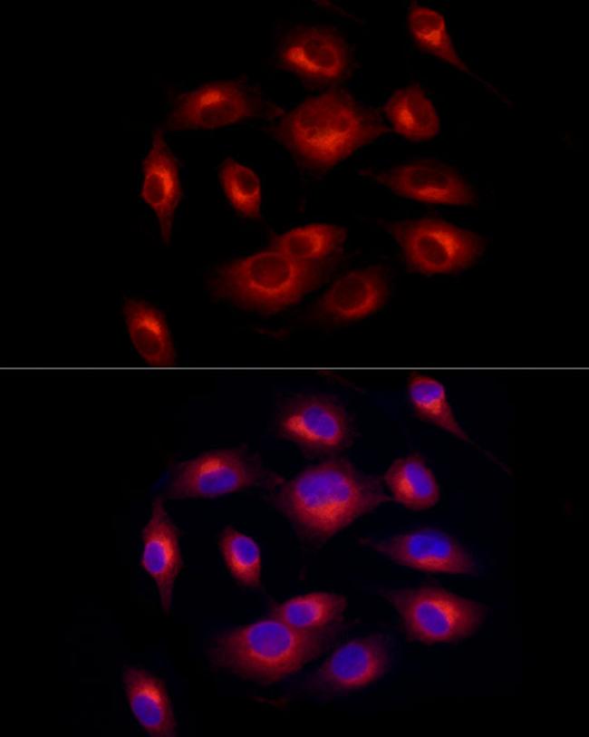 Melan-A Antibody in Immunocytochemistry (ICC/IF)