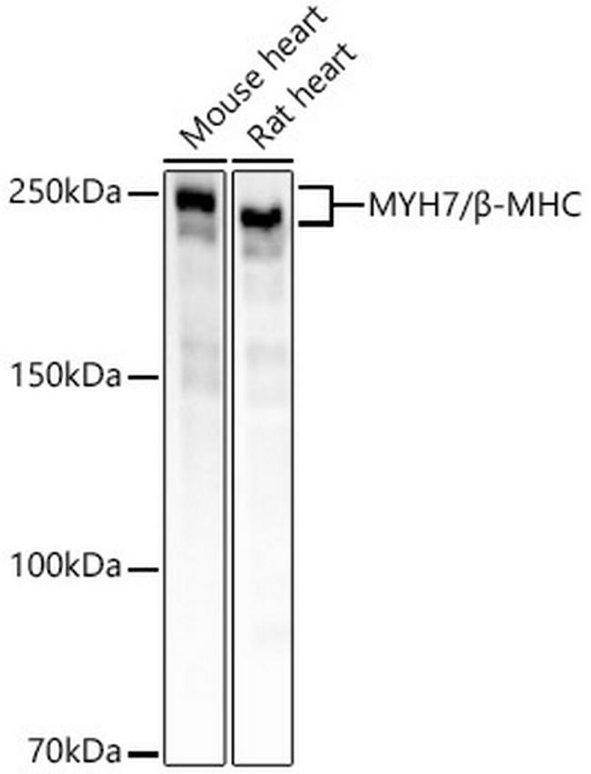 MYH7 Antibody in Western Blot (WB)