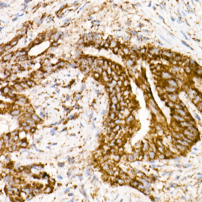 NDUFS1 Antibody in Immunohistochemistry (Paraffin) (IHC (P))