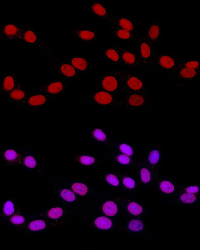 RbAp46 Antibody in Immunocytochemistry (ICC/IF)