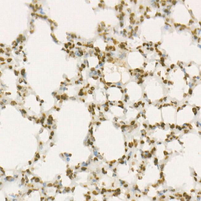 WEE1 Antibody in Immunohistochemistry (Paraffin) (IHC (P))