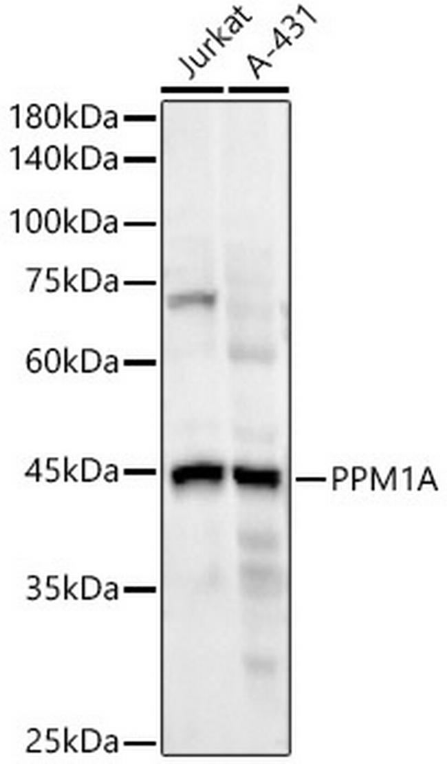 PPM1A Antibody in Western Blot (WB)