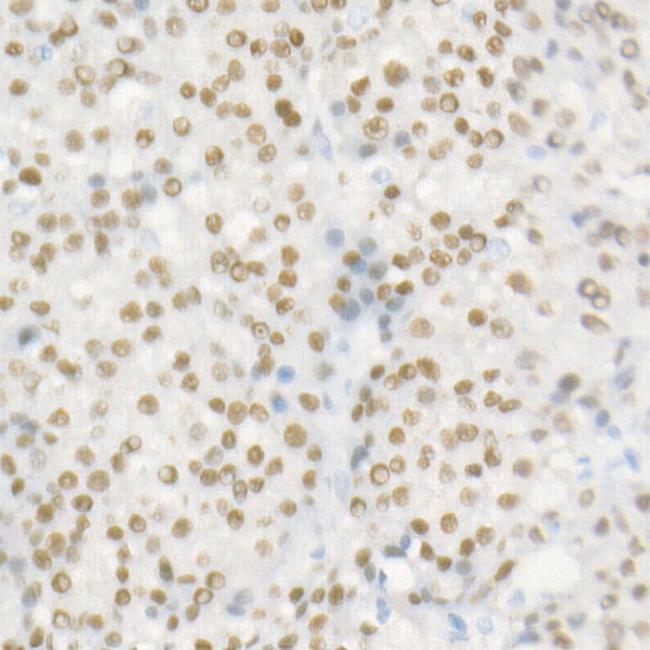 HNF1A Antibody in Immunohistochemistry (Paraffin) (IHC (P))