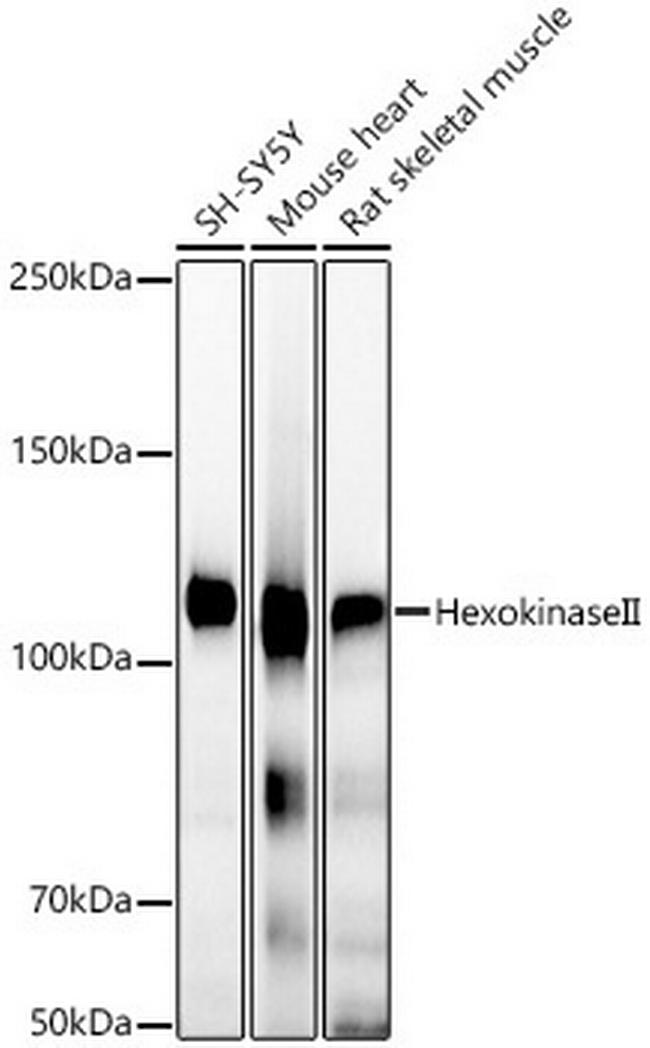 HK2 Antibody in Western Blot (WB)