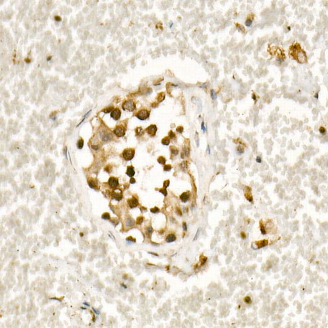 SMAD3 Antibody in Immunohistochemistry (Paraffin) (IHC (P))