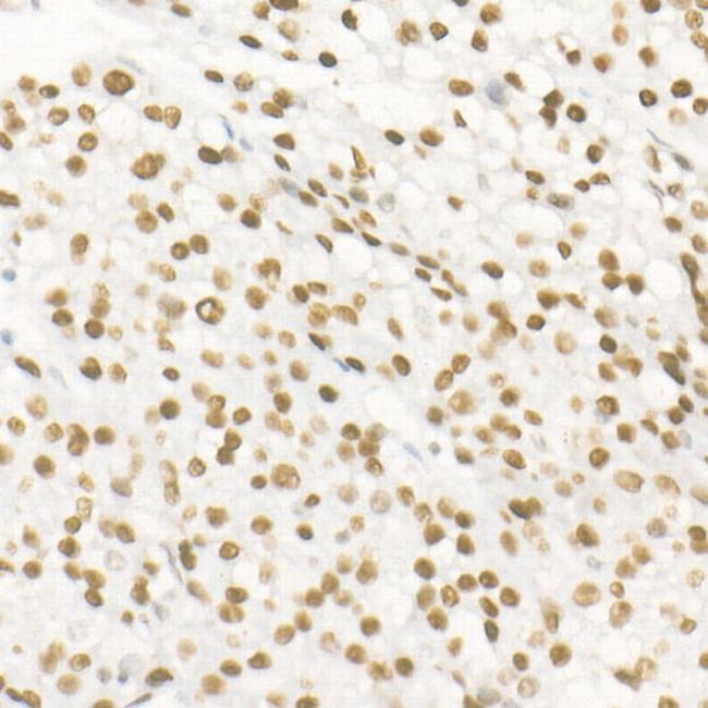 DNA Ligase III Antibody in Immunohistochemistry (Paraffin) (IHC (P))