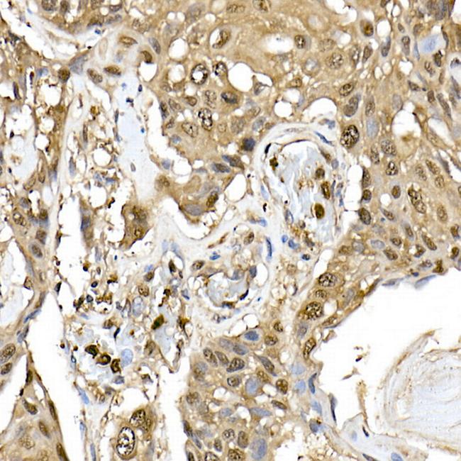 ERK1/ERK2 Antibody in Immunohistochemistry (Paraffin) (IHC (P))