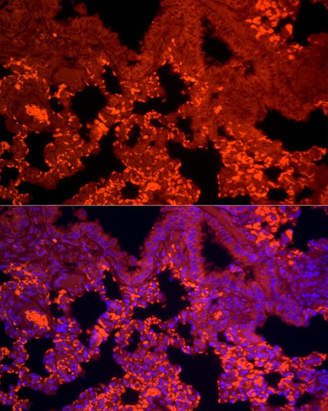 TGF beta-1 Antibody in Immunocytochemistry (ICC/IF)