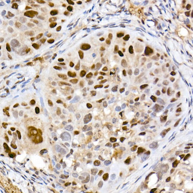 DNMT1 Antibody in Immunohistochemistry (Paraffin) (IHC (P))