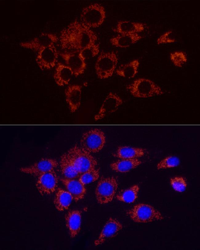 SDHC Antibody in Immunocytochemistry (ICC/IF)