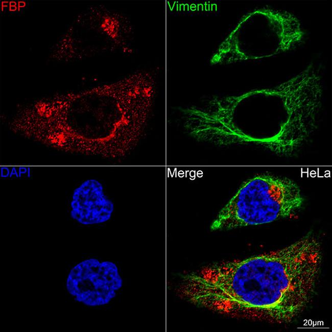 Folate Receptor alpha Antibody in Immunocytochemistry (ICC/IF)