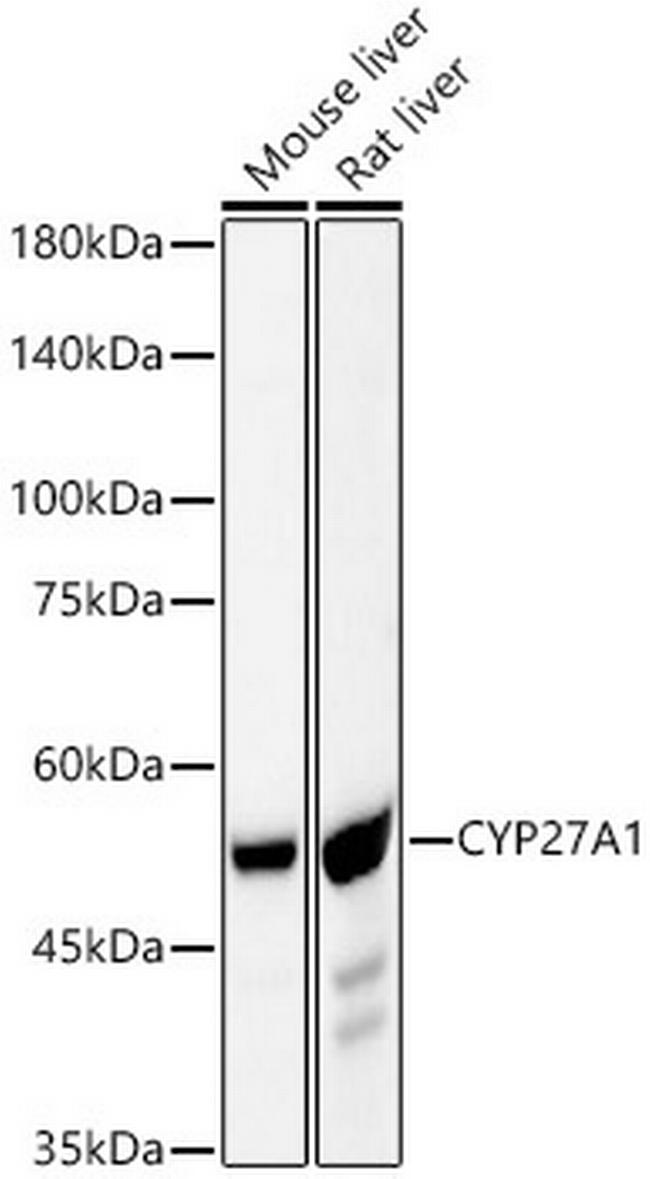 CYP27A1 Antibody in Western Blot (WB)