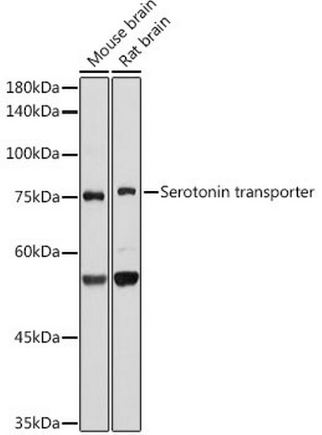 SLC6A4 Antibody in Western Blot (WB)