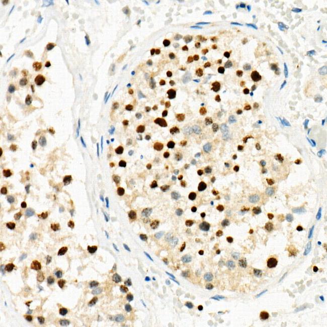 RNF8 Antibody in Immunohistochemistry (Paraffin) (IHC (P))