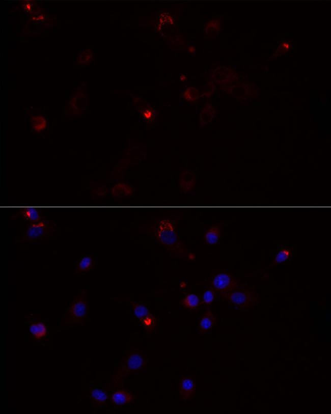 MMP3 Antibody in Immunocytochemistry (ICC/IF)