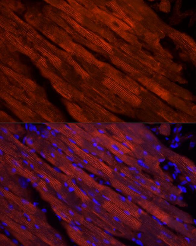 Cardiac Troponin I Antibody in Immunocytochemistry (ICC/IF)