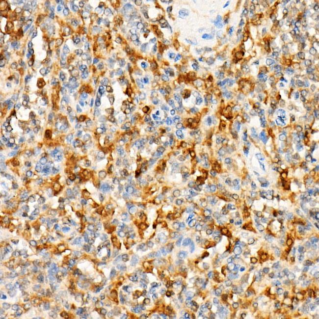 PLCB2 Antibody in Immunohistochemistry (Paraffin) (IHC (P))