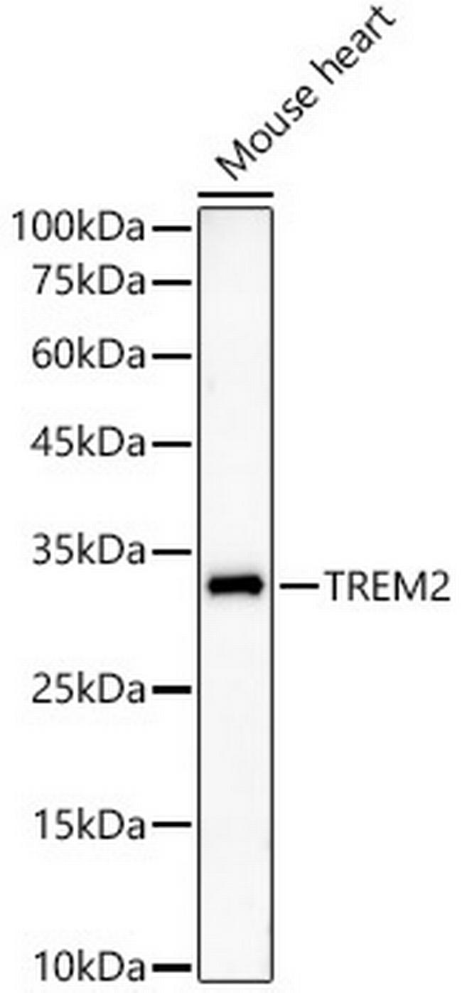 TREM2 Antibody in Western Blot (WB)