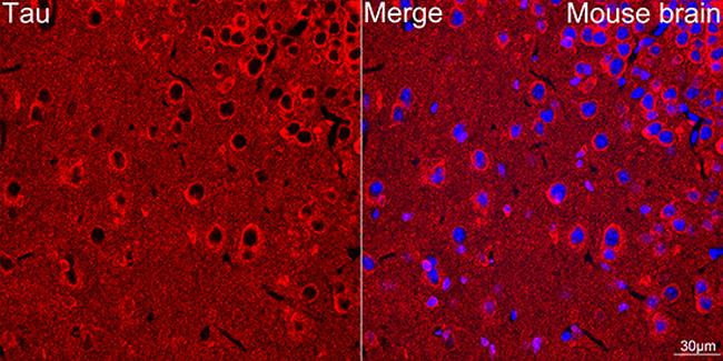 Tau Antibody in Immunocytochemistry (ICC/IF)