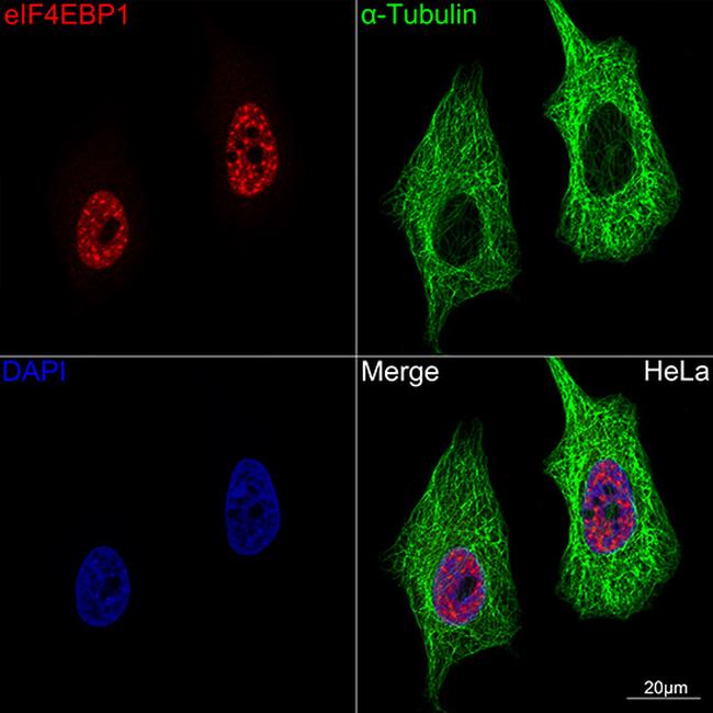 4EBP1 Antibody in Immunocytochemistry (ICC/IF)