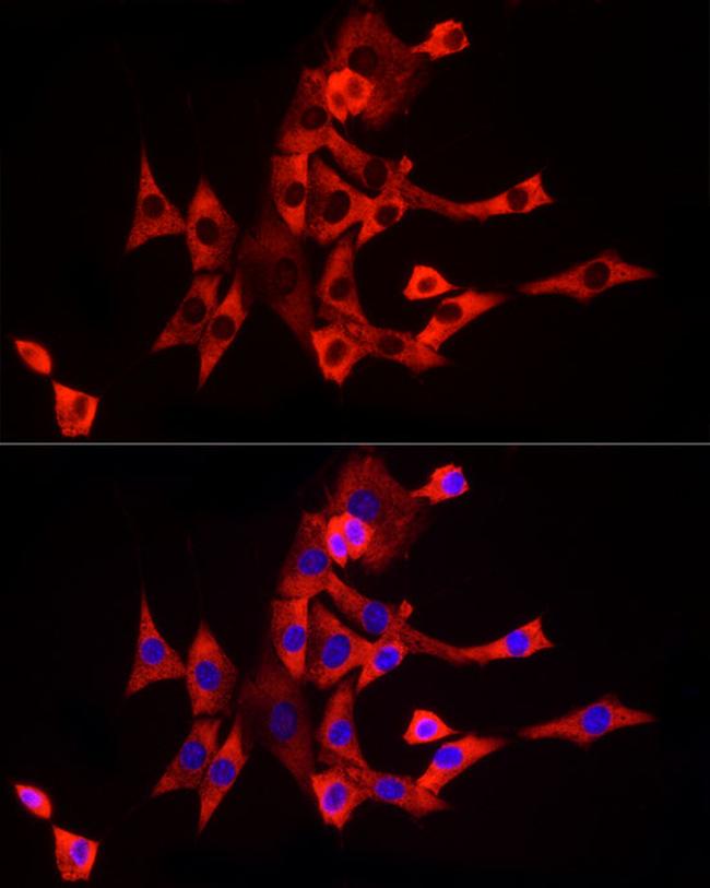 eIF4A1 Antibody in Immunocytochemistry (ICC/IF)