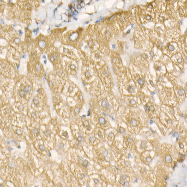 GRP78 Antibody in Immunohistochemistry (Paraffin) (IHC (P))