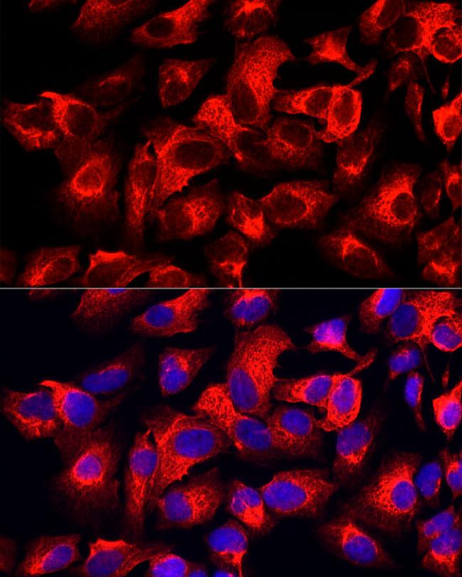 Cytokeratin 17 Antibody in Immunocytochemistry (ICC/IF)