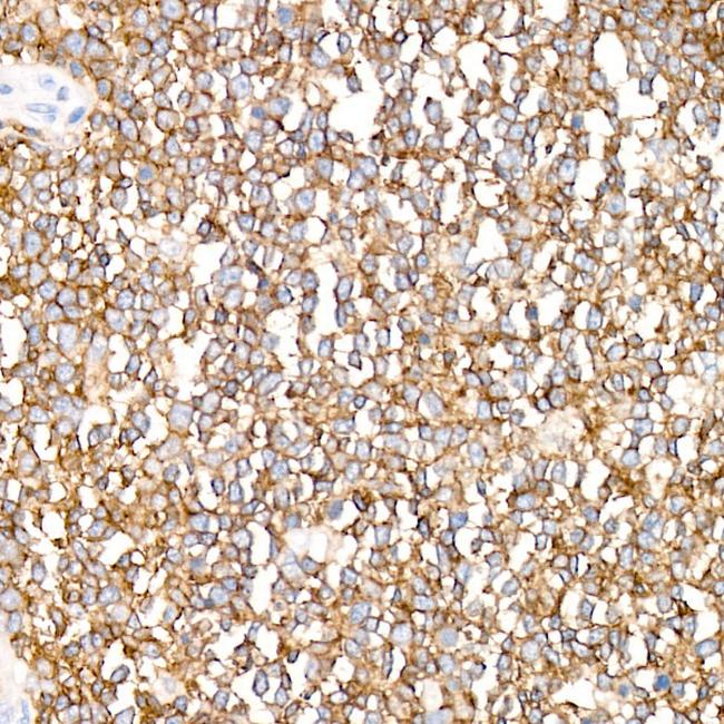 Ly-108 Antibody in Immunohistochemistry (Paraffin) (IHC (P))