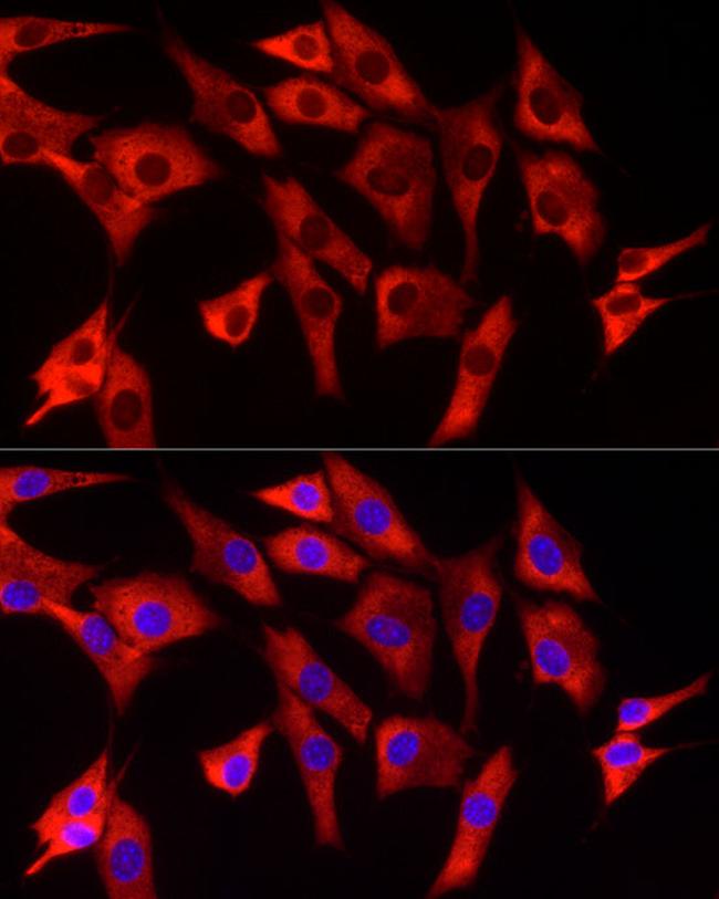 EIF4A1/EIF4A2/EIF4A3 Antibody in Immunocytochemistry (ICC/IF)