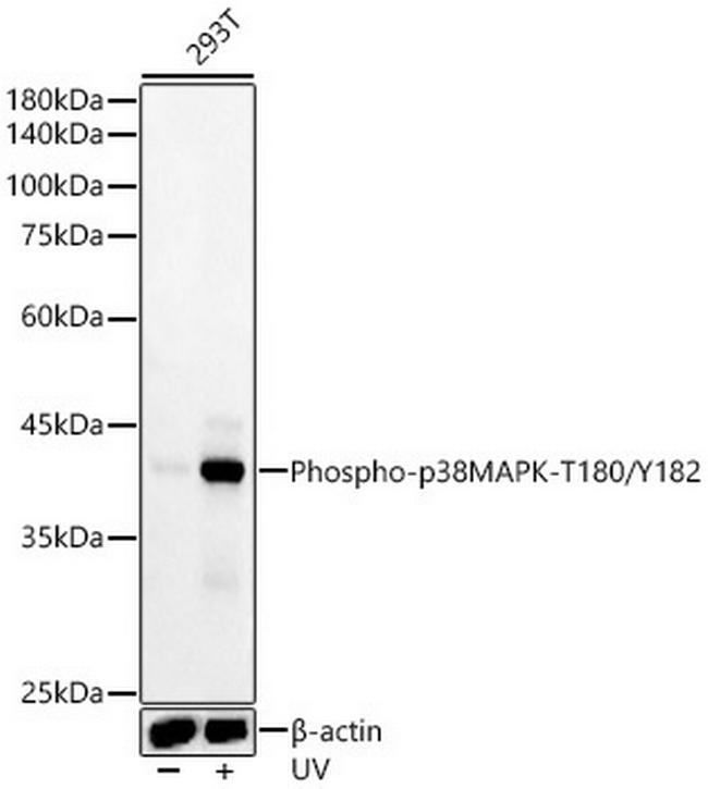 Phospho-p38 MAPK (Thr180, Tyr182) Antibody in Western Blot (WB)