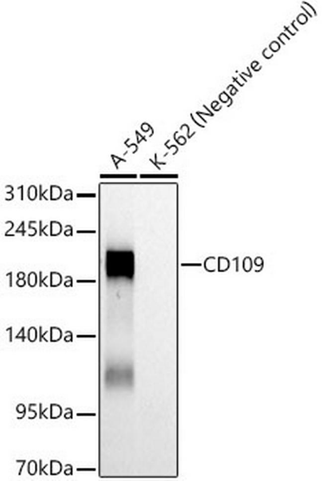 CD109 Antibody in Western Blot (WB)